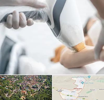 تجهیزات پزشکی زیبایی در دماوند