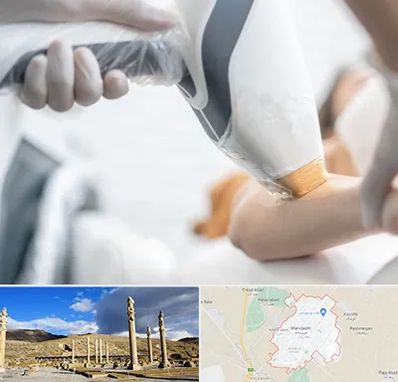 تجهیزات پزشکی زیبایی در مرودشت