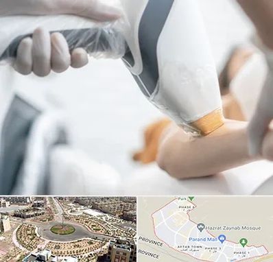 تجهیزات پزشکی زیبایی در پرند