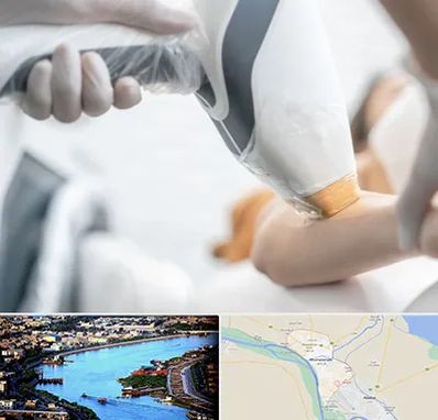 تجهیزات پزشکی زیبایی در خرمشهر