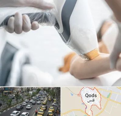 تجهیزات پزشکی زیبایی در شهر قدس