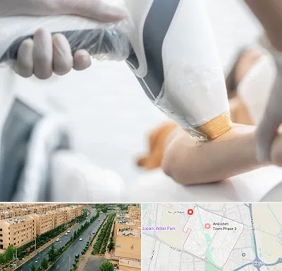 تجهیزات پزشکی زیبایی در فاز سه اندیشه