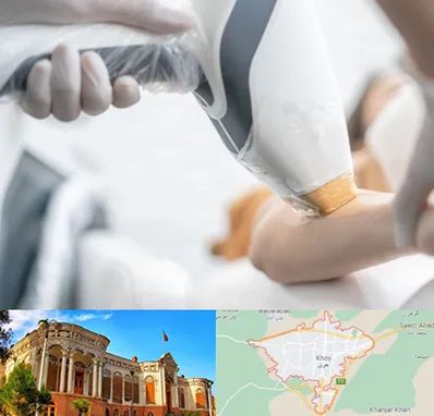 تجهیزات پزشکی زیبایی در خوی