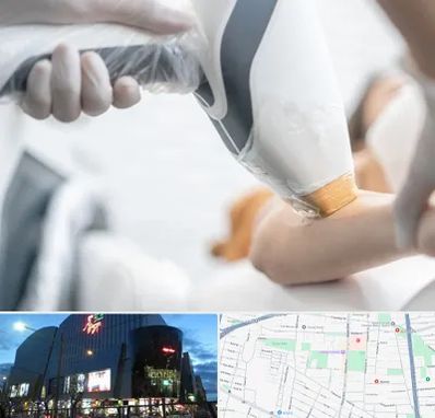 تجهیزات پزشکی زیبایی در بلوار اباذر