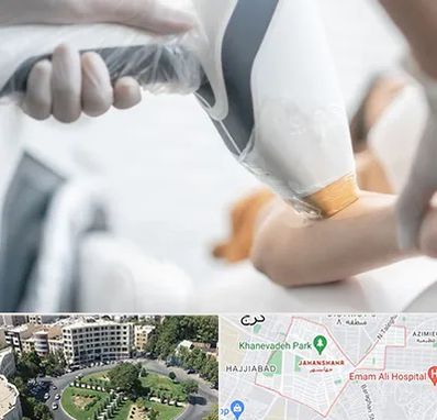 تجهیزات پزشکی زیبایی در جهانشهر کرج 