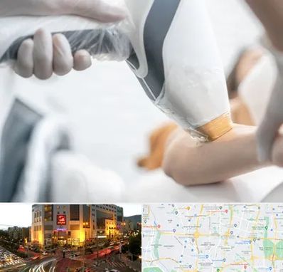 تجهیزات پزشکی زیبایی در جنت آباد تهران 