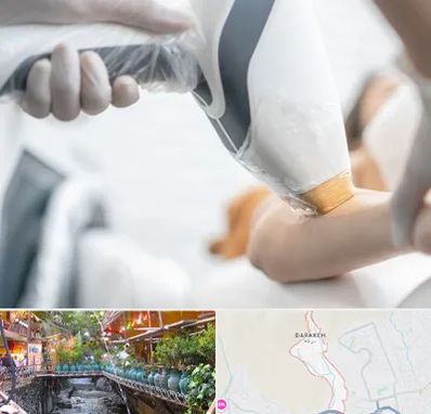 تجهیزات پزشکی زیبایی در درکه