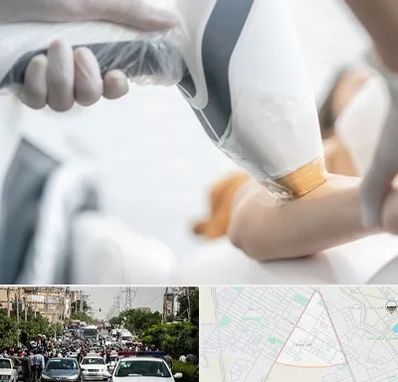 تجهیزات پزشکی زیبایی در سیدی مشهد