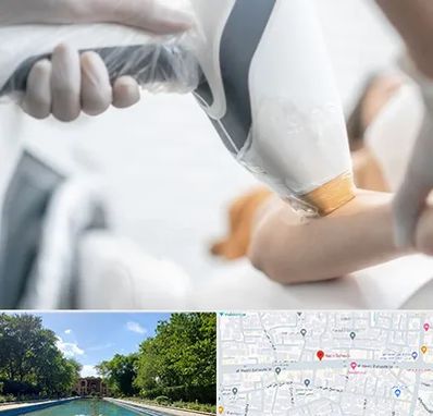 تجهیزات پزشکی زیبایی در هشت بهشت اصفهان