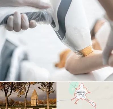 تجهیزات پزشکی زیبایی در تویسرکان