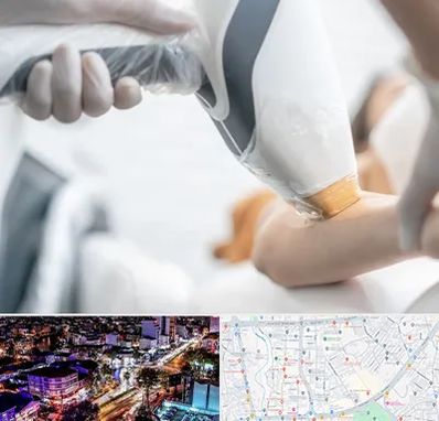 تجهیزات پزشکی زیبایی در منظریه رشت