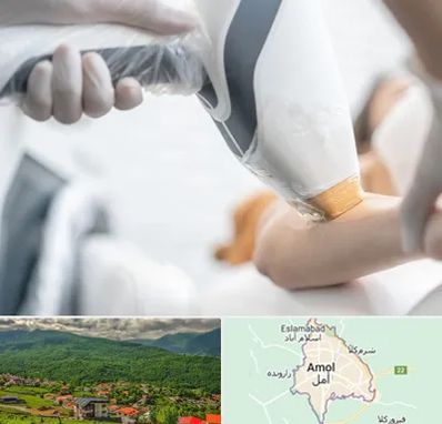 تجهیزات پزشکی زیبایی در آمل