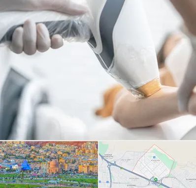 تجهیزات پزشکی زیبایی در رشدیه تبریز