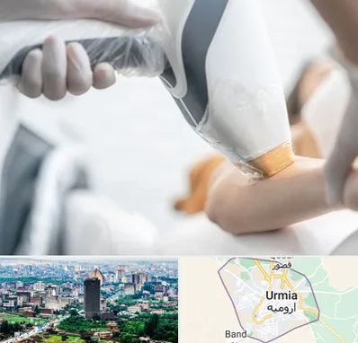 تجهیزات پزشکی زیبایی در ارومیه