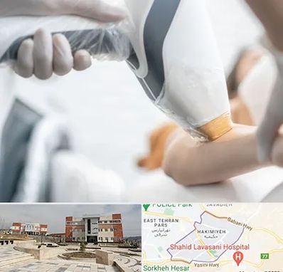 تجهیزات پزشکی زیبایی در حکیمیه 