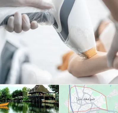 تجهیزات پزشکی زیبایی در صومعه سرا