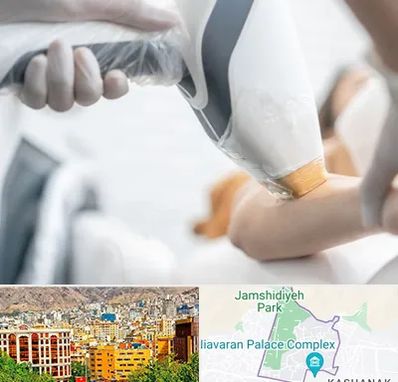 تجهیزات پزشکی زیبایی در نیاوران 