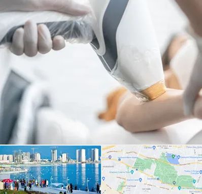 تجهیزات پزشکی زیبایی در چیتگر 