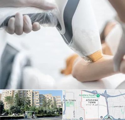 تجهیزات پزشکی زیبایی در آپادانا