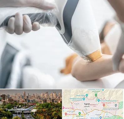 تجهیزات پزشکی زیبایی در منطقه 1 تهران 