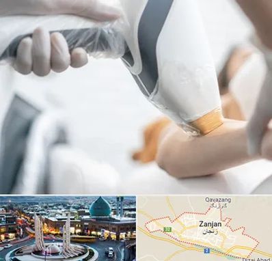 تجهیزات پزشکی زیبایی در زنجان