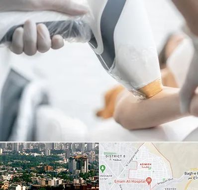 تجهیزات پزشکی زیبایی در عظیمیه کرج 