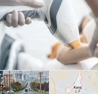 تجهیزات پزشکی زیبایی در گوهردشت کرج 