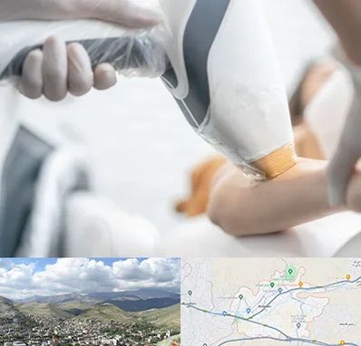 تجهیزات پزشکی زیبایی در رودهن