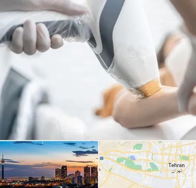 تجهیزات پزشکی زیبایی در غرب تهران 