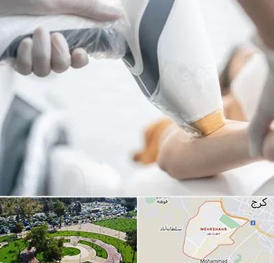 تجهیزات پزشکی زیبایی در مهرشهر کرج 