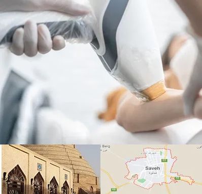 تجهیزات پزشکی زیبایی در ساوه