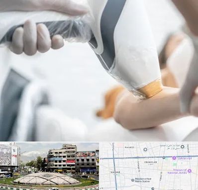 تجهیزات پزشکی زیبایی در مرکز تهران