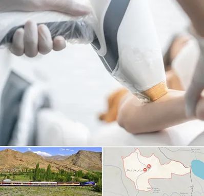 تجهیزات پزشکی زیبایی در خاش