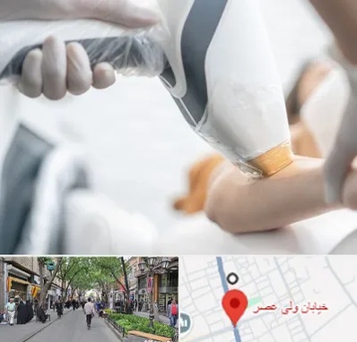 تجهیزات پزشکی زیبایی در ولیعصر شهریار