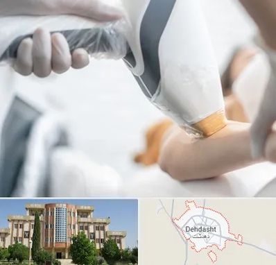 تجهیزات پزشکی زیبایی در دهدشت