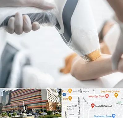 تجهیزات پزشکی زیبایی در سهروردی 