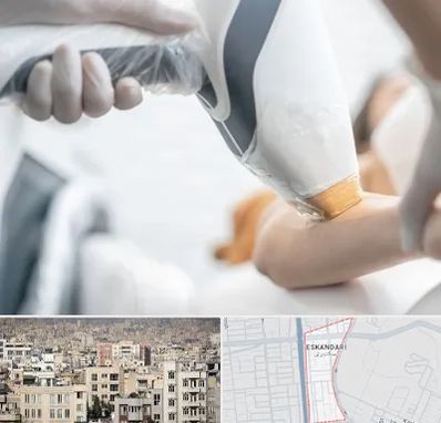 تجهیزات پزشکی زیبایی در اسکندری