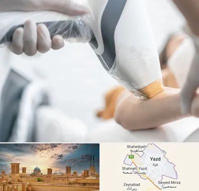 تجهیزات پزشکی زیبایی در یزد
