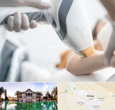 تجهیزات پزشکی زیبایی در شیراز