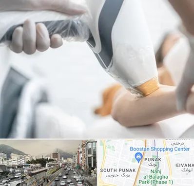 تجهیزات پزشکی زیبایی در پونک 