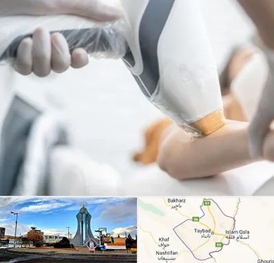 تجهیزات پزشکی زیبایی در تایباد