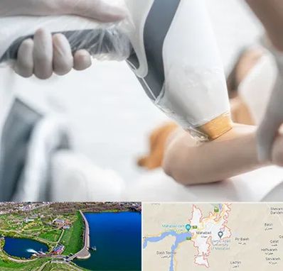 تجهیزات پزشکی زیبایی در مهاباد