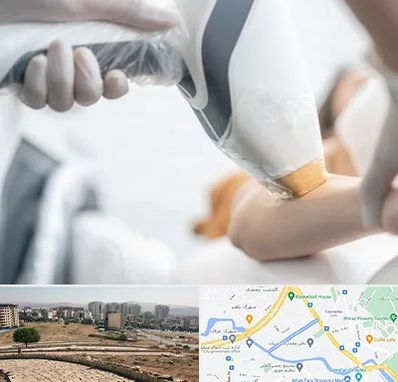 تجهیزات پزشکی زیبایی در کوی وحدت شیراز