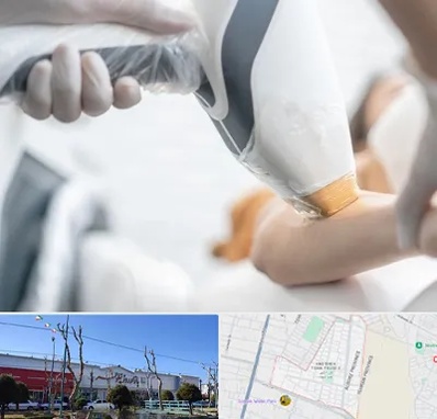 تجهیزات پزشکی زیبایی در فاز دو اندیشه