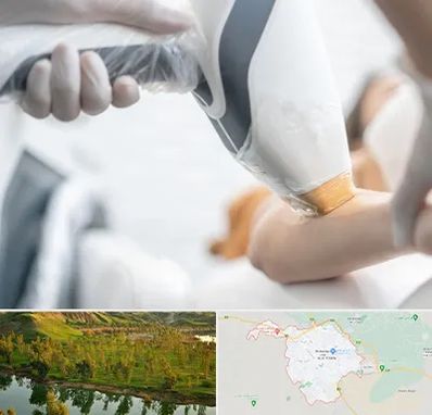 تجهیزات پزشکی زیبایی در بهبهان