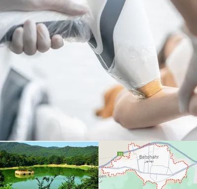تجهیزات پزشکی زیبایی در بهشهر