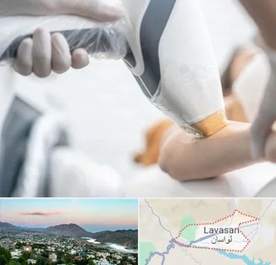 تجهیزات پزشکی زیبایی در لواسان