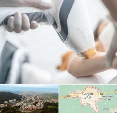 تجهیزات پزشکی زیبایی در گرگان