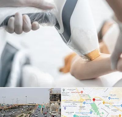 تجهیزات پزشکی زیبایی در بلوار توس مشهد 