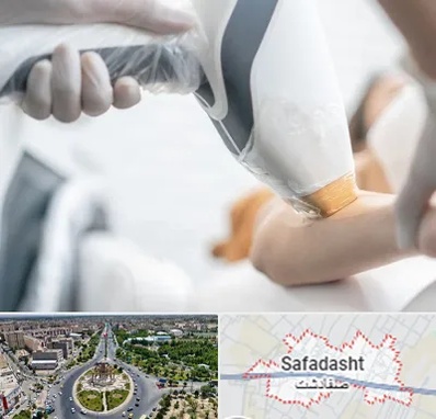 تجهیزات پزشکی زیبایی در صفادشت